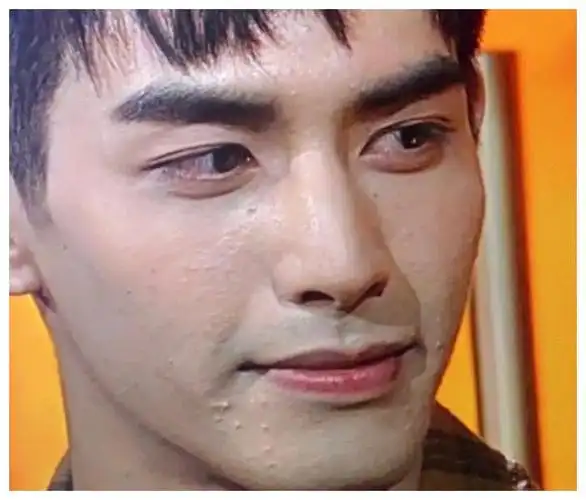 21岁宋威龙上金鹰节,无美颜直播生图流出,皮肤状态引热议