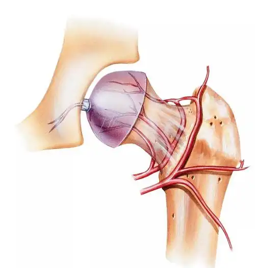 那么股骨头坏死症状都有哪些?