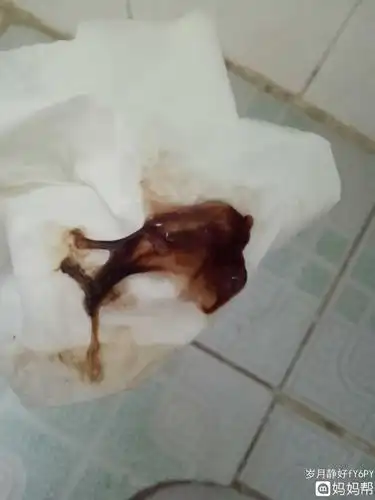 3个多月白带偏褐色