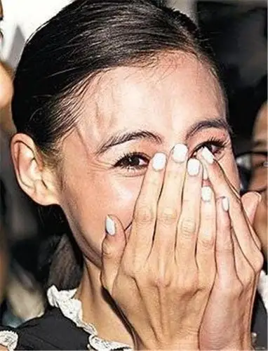 张柏芝最新照片曝光,不仅瘦成了郑爽,而且全身伤