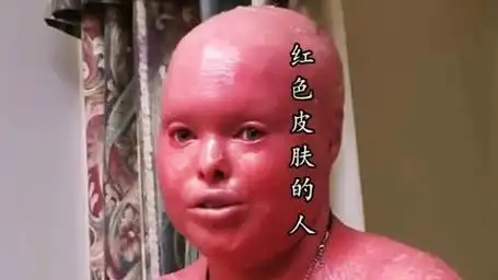 红色皮肤的人!