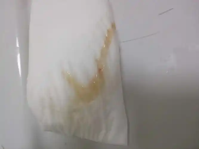 [准备怀孕]排卵13天左右,连着两三天白带里面都带有少量的血丝,什么