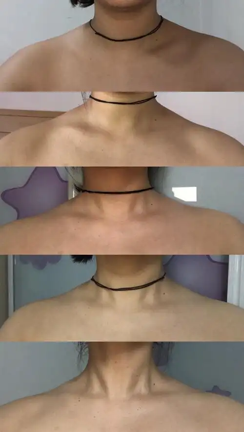 大家帮我看一下,我的斜方肌是不是变高了