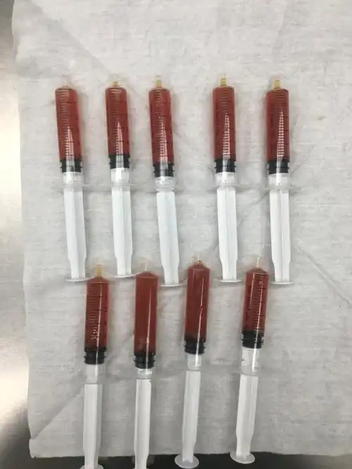 术中抽取血性淋巴液(出血量少)治疗后病灶完全消失本文系李炯医生授权