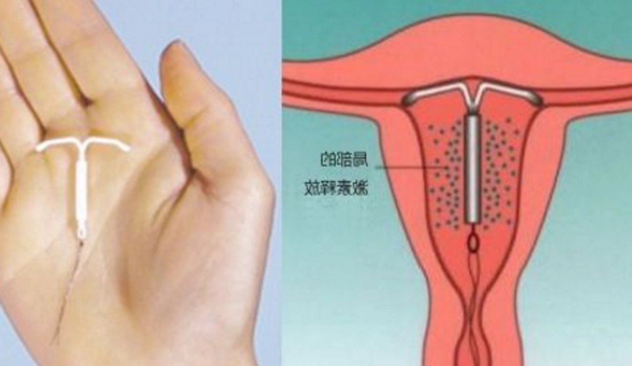 一般来说,节育环也有它一定的使用期限,如果不取出,那么子宫萎缩以后