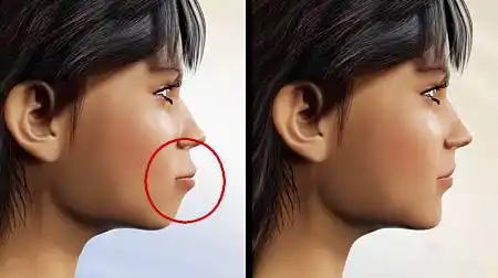 沈腾:老觉得没长虎牙,我这人就完美了