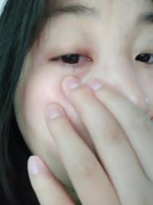 女生左眼下有这个痣,都有哪些解释呀