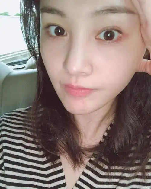 郑爽素颜自拍曝光皮肤超细腻,嘴角的疤和下巴的痘痘亮
