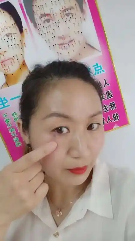 老公我有一棵眼泪痣之前也没有注意这个痣非常不好哭夫痣刚才我自己把