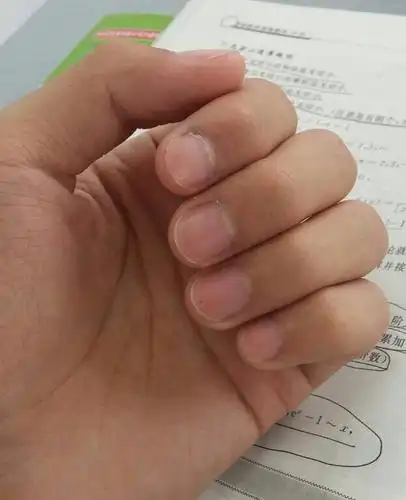 大家看一下我指甲颜色正常吗,我感觉我的指甲根部有些发青,我看一篇