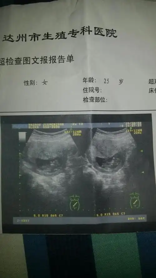 10周时做的b超,医生说快发育成小人了