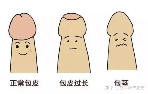 你好,当包皮环切手术后,龟头即可正常露出,于正常成人状态相同.