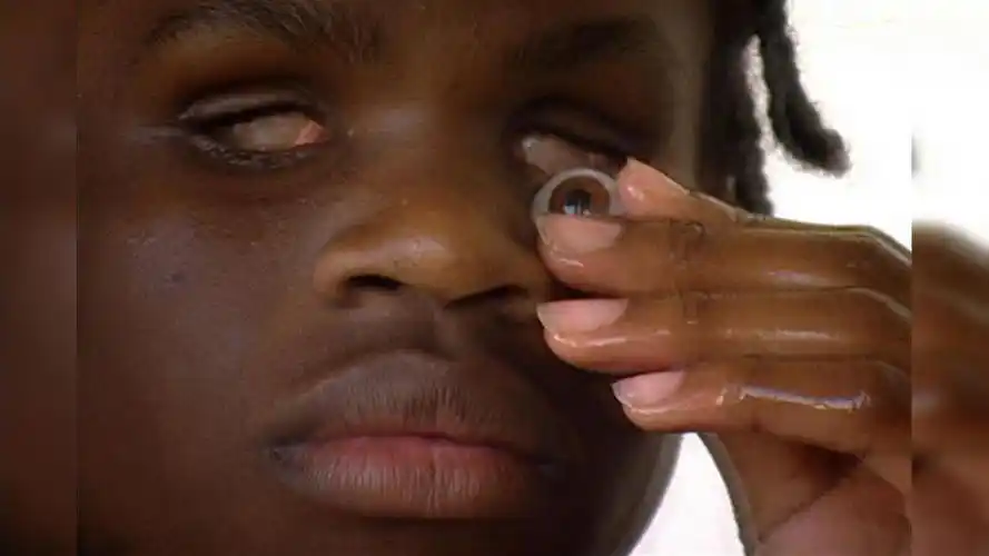 和海豚一样靠回声定位的男孩:抠掉眼珠也能看见