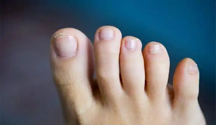小脚趾甲两瓣是哪族人满族人的小脚趾甲为什么是两瓣的