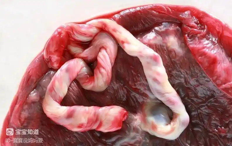 产妇坐月子喝了胎盘汤发生这种意外胎盘真的大补吗