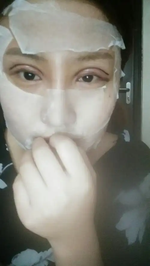 我刚做完的眼睛第二天 我说要欧式平行双眼皮,他给我做成这样 不知道