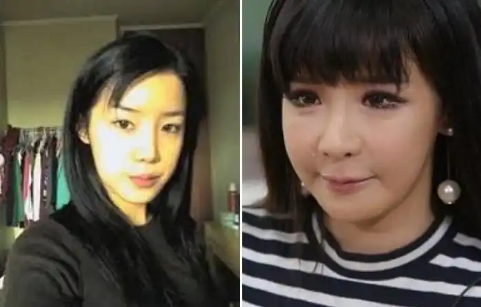 盘点整容前更漂亮的5位韩国艺人