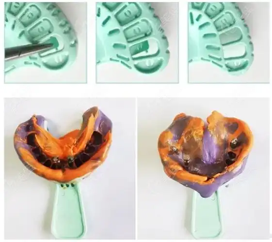 种植牙取模疼吗种植牙取模的标准流程可以了解下