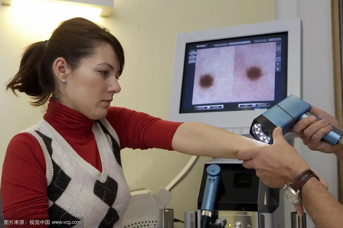 皮肤科医生,皮肤科医生用视频皮肤镜检查病人,德国,欧洲