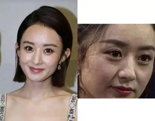 放大20倍焦距,原来女明星们也都是黑头专业户!