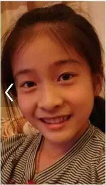 张雪迎就是童星出道的,现在看到她小时候的样子长相很一般,但是现在很