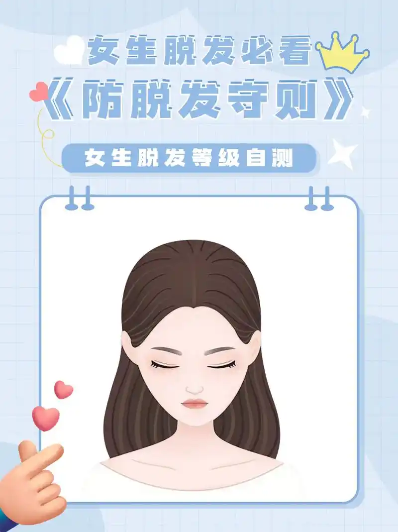 女生脱发等级自测 #掉发 #防脱生发  #图文伙伴计划 #开 - 抖音