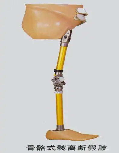 tc-髋离断假肢