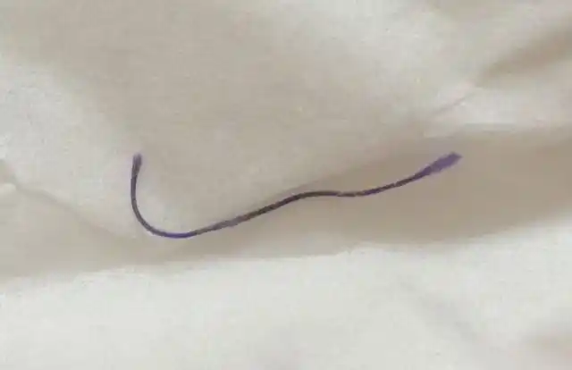 羊脂线自动脱落(附图 不吓人哈)