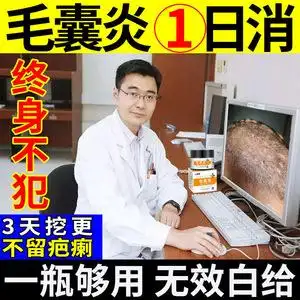 毛囊炎膏治疗头皮头部脸部胸后背手臂腿头上长痘痘疙瘩特效专用药