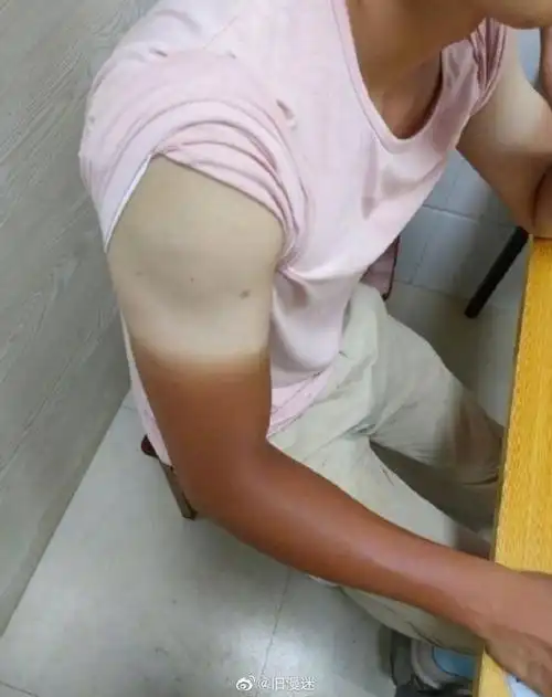 双胞胎海南游后弟弟晒成黑炭#防止自己晒黑,我几乎夏天都不怎么出门