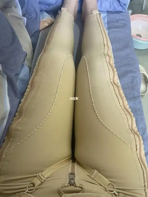 女人大腿根合不拢是什么原因