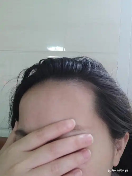 额头凸和发际线高这两点一般都会同时存在吗? - 知乎