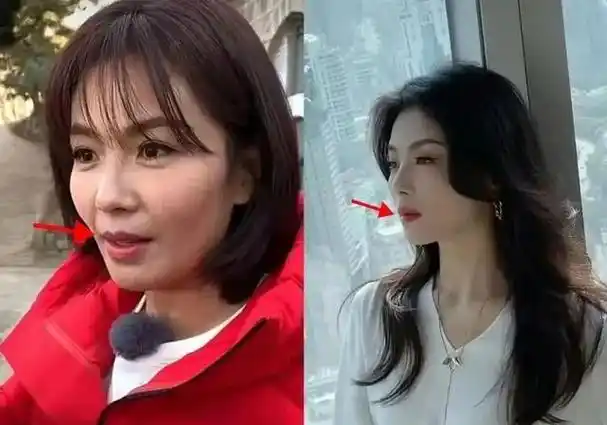 刘涛动脸了吗?撞脸宋慧乔!