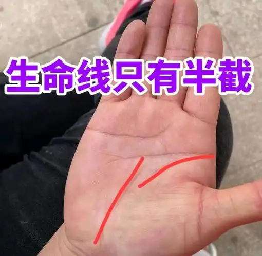 生命线短寿命就短吗?