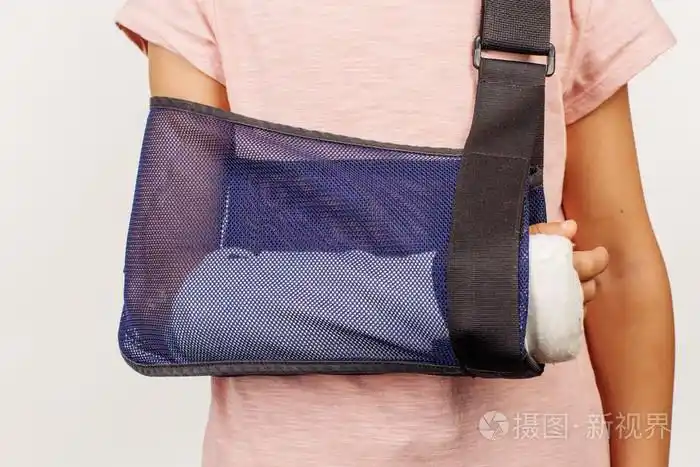 女孩的手臂骨折,在一条绷带.这张照片的概念是结合