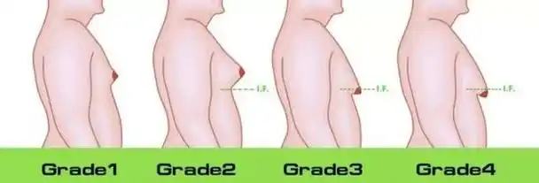 男生的胸大有什么影响(会给男人带来什么麻烦)(10)