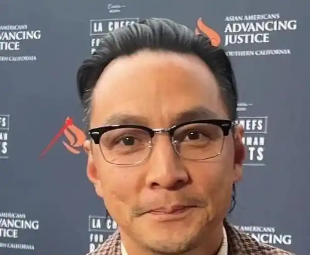 头发少对男星伤害有多大邓超45岁像大爷阮经天留长发才显年轻