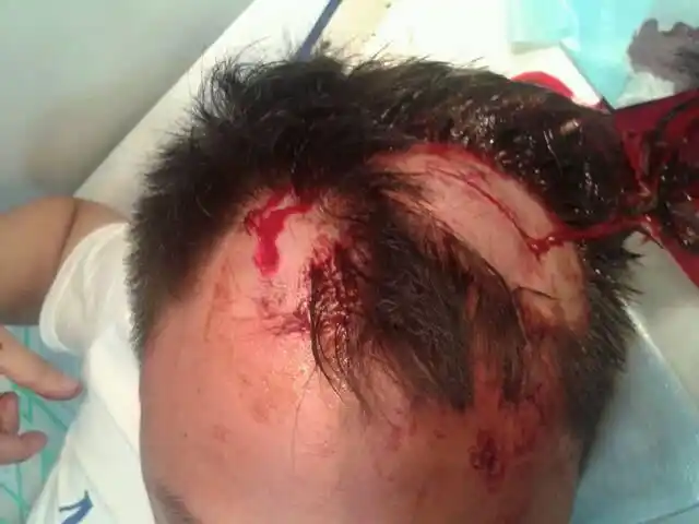 被三人拿刀把头部砍伤,这三人最多能判刑几年?