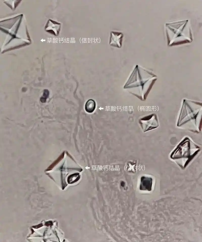 显微镜下的尿液结晶.#每天学习一点点 #显微镜 - 抖音