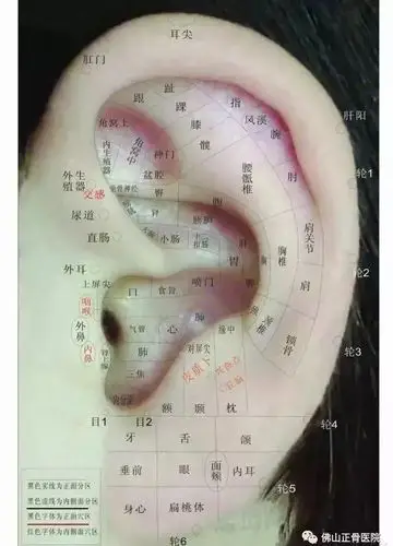 [疗法推荐]藏正气,除病痛——王不留行籽耳穴压豆