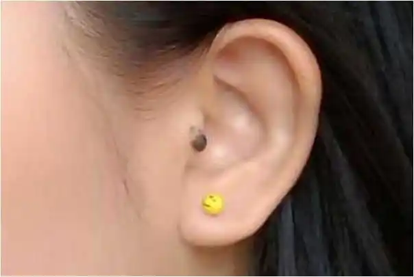 女人身上这四颗招财痣,哪怕有一个也让你命带财库,越老越旺夫!