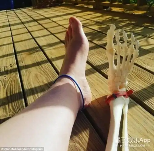 姑娘做完截肢手术把自己的腿做成了标本一起旅行