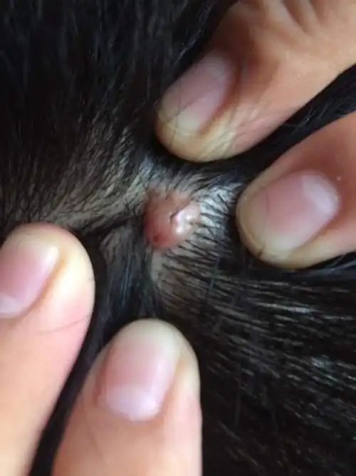 请问我头上这个肉疙瘩是什么东西?在我头上好多年了,而且还随着时间