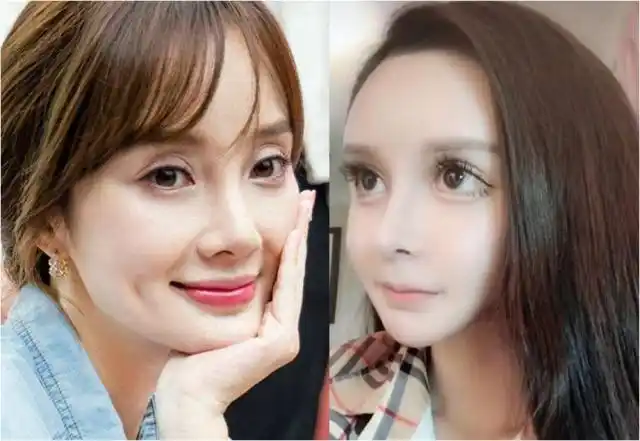 天然的脸和整容的脸其实很好辨别,整容脸的这几个地方很不自然