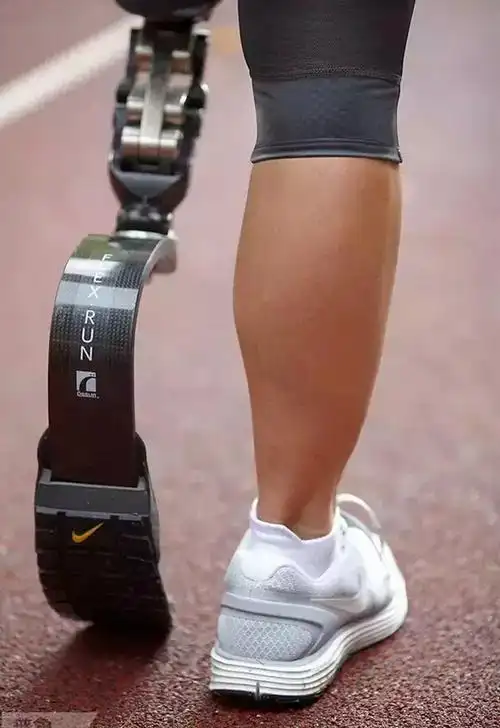 佳满假肢假肢一样可以做得很酷