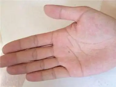 女人发横财的痣 女人这几处有痣是富贵痣