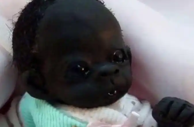 世界上"最黑"的女婴儿,这么多年过去了,如今怎么样了?_网遛网