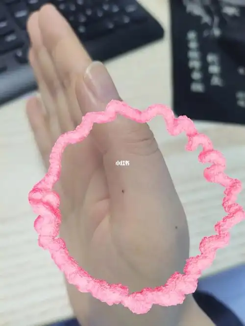 右手大拇指突然长了两颗痣是虾米情况#右手长痣