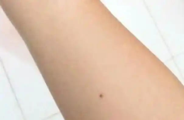 女人手臂内侧长痣好不好忍耐力强桃花旺人际关系不好