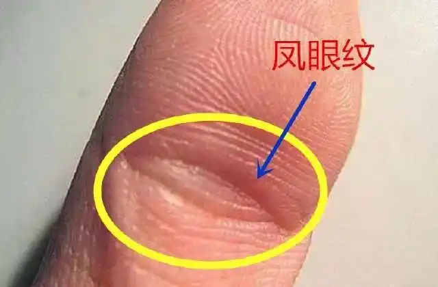这些关于凤眼纹的知识你了解多少?-周易易学讲堂-手相研究